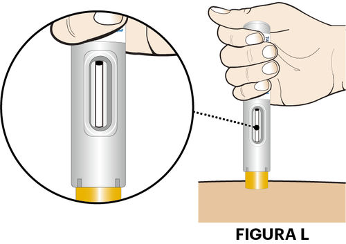 Mano che tiene un dispositivo per iniezione auto-iniettabile con ago giallo puntato sulla pelle beige e ingrandimento del dispositivo