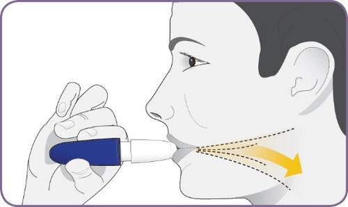 Profilo di una donna con un applicatore nasale blu in mano e una freccia gialla che indica la direzione di inserimento