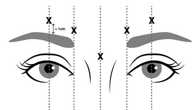 Due occhi stilizzati con sopracciglia, linee verticali punteggiate e croci che indicano punti di iniezione a 1cm di distanza