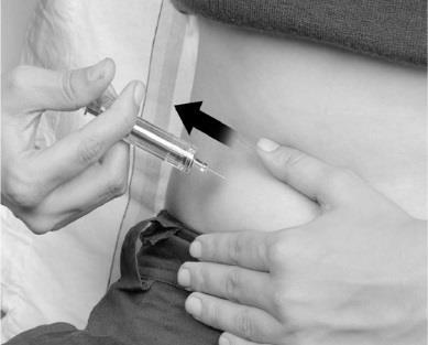 Iniezione sottocutanea con siringa, ago inserito nell