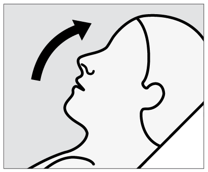Profilo di una testa con una freccia curva nera che indica la direzione di inclinazione laterale del collo