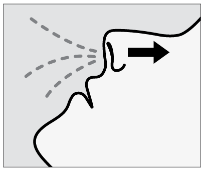 Iniezione sottocutanea con ago inclinato che rilascia il farmaco nel tessuto adiposo profondo freccia indica la direzione