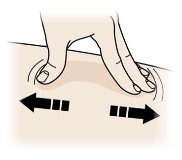 Mano che pizzica la pelle con due dita mostrando un piega cutanea e frecce nere che indicano la direzione del movimento