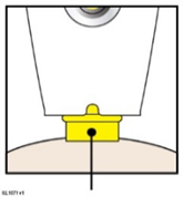 Dispositivo di iniezione auto-iniettante giallo con pulsante nero e ago inserito nella pelle beige