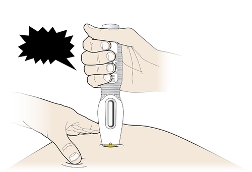 Mano che tiene un autoiniettore premuto sulla coscia di una persona con un piccolo puntino giallo che indica il sito di iniezione