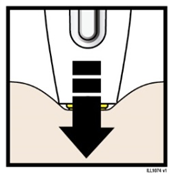 Dispositivo di iniezione sottocutanea con ago nero che penetra nella pelle beige e freccia nera indicante la direzione