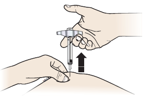 Mano che tiene un dispositivo per iniezione sottocutanea con ago inserito nella pelle e freccia che indica la direzione di spinta
