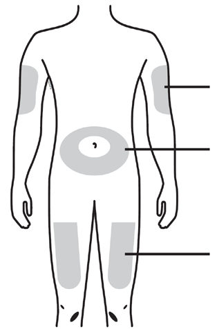 Schema del corpo umano con aree grigie che indicano possibili siti di iniezione sottocutanea su braccia, cosce e addome