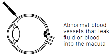 Sezione schematica dell