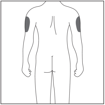 Schizzo del torso umano da dietro con aree ombreggiate sui deltoidi e glutei indicando possibili siti di iniezione