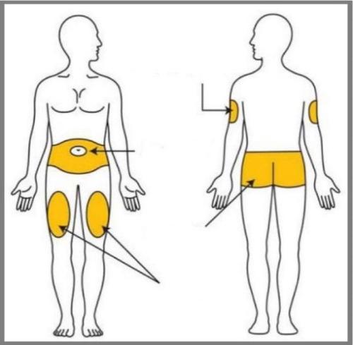 Schema corporeo con aree evidenziate in giallo per iniezioni intramuscolari: glutei, cosce e braccia
