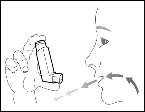 Mano che tiene un inalatore vicino alla bocca con frecce che indicano il percorso del farmaco inspirato verso i polmoni profilo del viso