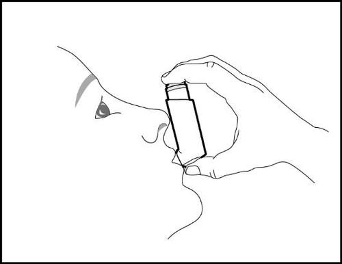 Profilo di un viso con una mano che tiene un inalatore vicino alla bocca per l