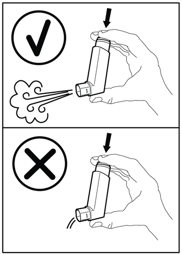 Inalatore tenuto correttamente con spruzzo visibile sopra e inalatore tenuto in modo errato con spruzzo laterale frecce indicano direzione
