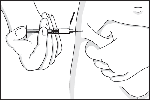 Mano che tiene una siringa con ago inserito nella pelle del braccio, tecnica di iniezione sottocutanea con piega cutanea creata dall