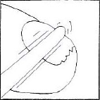 Mano che stringe una siringa con ago inserito nella pelle, tecnica di iniezione sottocutanea con piega cutanea sollevata