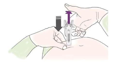 Mano che preme un dispositivo autoiniettante sulla coscia con freccia nera indicante la pressione