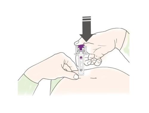 Mano che tiene un dispositivo per iniezione sottocutanea con ago inserito nella pelle dell