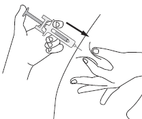 Mano che tiene una siringa inclinata, ago che penetra nella pelle, freccia nera indica la direzione dell
