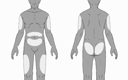 Schema corporeo con aree evidenziate per iniezioni intramuscolari su braccia, glutei, cosce e fianchi vista frontale e dorsale