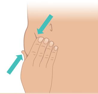 Mano che solleva un lembo di pelle con un pollice e un dito indice mentre una freccia indica il punto di iniezione laterale