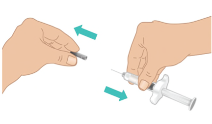 Mani che preparano una siringa preriempita con ago protettivo, frecce blu indicano la direzione di montaggio