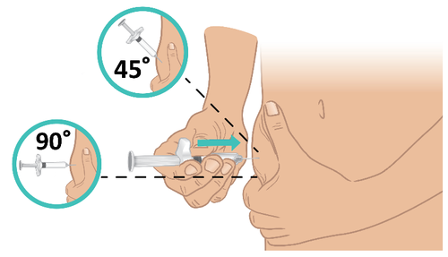 Mano che tiene una siringa inclinata a 45° per iniezione sottocutanea nella coscia, con freccia blu che indica la direzione e angolazioni di 45° e 90° indicate