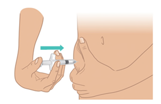 Mano che pizzica la pelle e introduce un ago di siringa sottocute con una freccia blu che indica la direzione