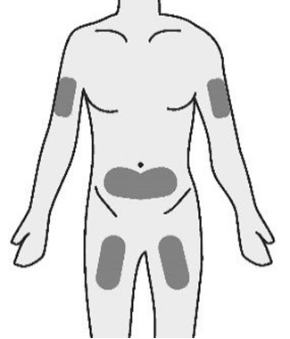 Corpo umano stilizzato con aree grigie che indicano possibili siti di iniezione sottocutanea su braccia, fianchi e addome