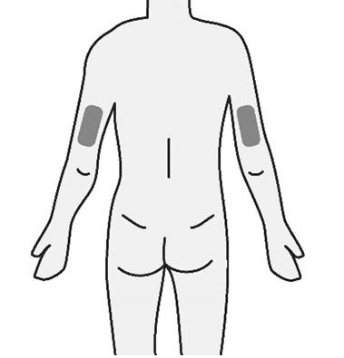 Schema del corpo umano con aree grigie che indicano i siti di iniezione sulla parte superiore del braccio