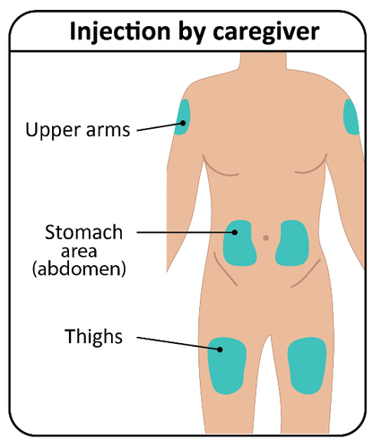 Schema del corpo umano con aree indicate per iniezioni sottocutanee braccia, addome e cosce evidenziate in blu