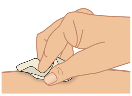 Mano che applica un cerotto adesivo sulla pelle chiara del braccio con un movimento delicato