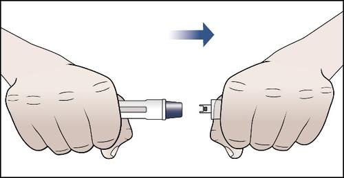 Due mani che assemblano un dispositivo medico con un cilindro e un cappuccio protettivo blu