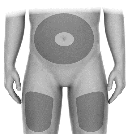Torso umano stilizzato con aree grigie che indicano i siti di iniezione addominale e sulle cosce