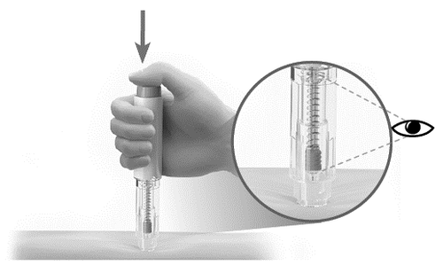 Mano che tiene un dispositivo per iniezione con ago inserito nella pelle e ingrandimento circolare del meccanismo interno