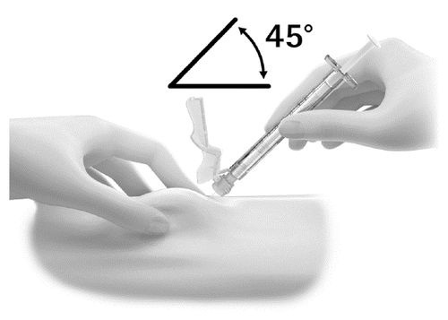 Mano che tiene una siringa inclinata a 45 gradi mentre l
