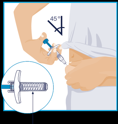 Mano che inietta farmaco sottocute con siringa a 45 gradi, dettaglio ago e meccanismo di sicurezza visibile in un cerchio