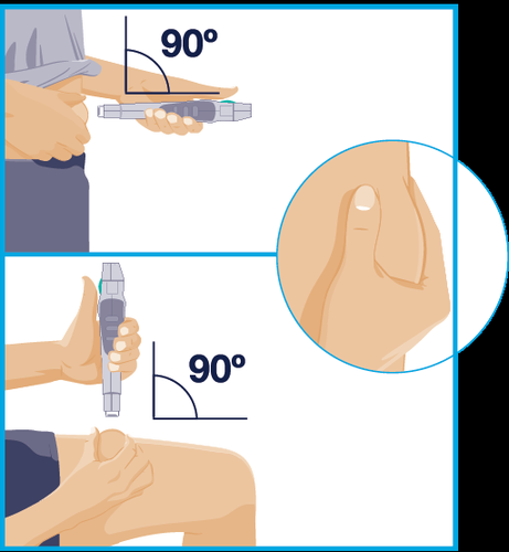 Iniezione sottocutanea con penna precompilata a 90 gradi e dettaglio ingrandito del punto di iniezione sulla coscia