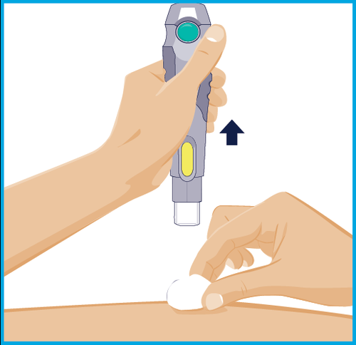 Mano che tiene un dispositivo per iniezione sottocutanea con ago rivolto verso la pelle pizzicata dall