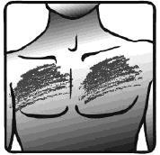 Schizzo di torace umano con indicazione delle zone di iniezione intramuscolare ombreggiate e linea verticale di riferimento