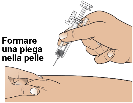 Mano che stringe una siringa con ago inserito nella pelle sollevata formando una piega, dettaglio del braccio e del punto di iniezione