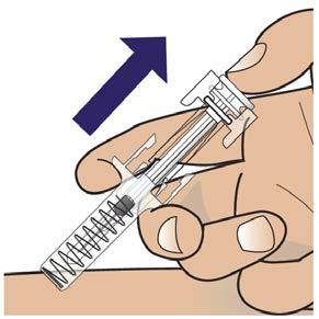 Mano che tiene una siringa preriempita con ago trasparente e protezione rimovibile freccia blu indica la direzione
