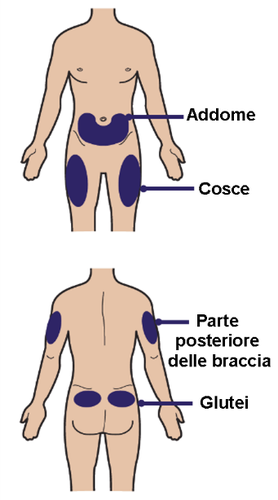 Schema corporeo umano con aree evidenziate per iniezioni: addome, cosce, parte posteriore braccia e glutei