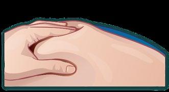 Mano che pizzica la pelle creando una piega, evidenziando strati cutanei e sottocutanei con tonalità chiare e scure