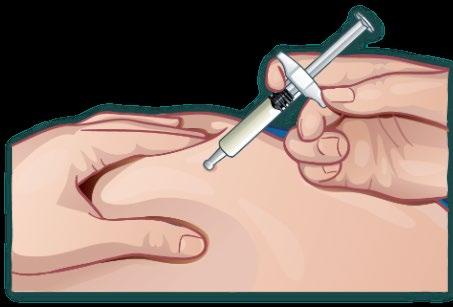 Mano che tiene una siringa precompilata pronta per l