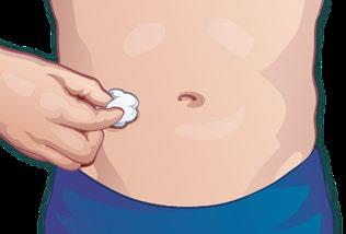 Mano che applica un batuffolo di cotone imbevuto su un punto specifico dell