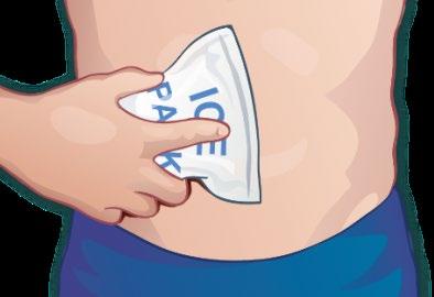 Mano che applica un impacco di ghiaccio sulla parte inferiore dell