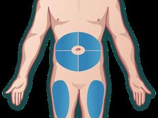 Torso umano stilizzato con aree evidenziate in blu per iniezioni sottocutanee addominali e laterali coscia