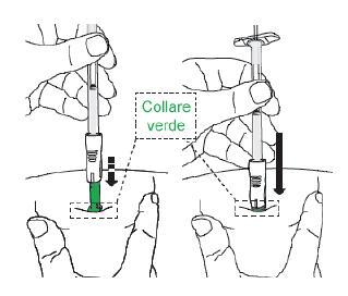 Mani che tengono un dispositivo per iniezione con ago inserito nella pelle, freccia indica la pressione verso il basso e dettaglio del collare verde