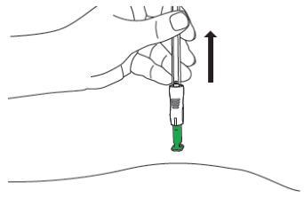 Mano che inserisce un dispositivo autoiniettante verde nella pelle con una freccia che indica la direzione di inserimento